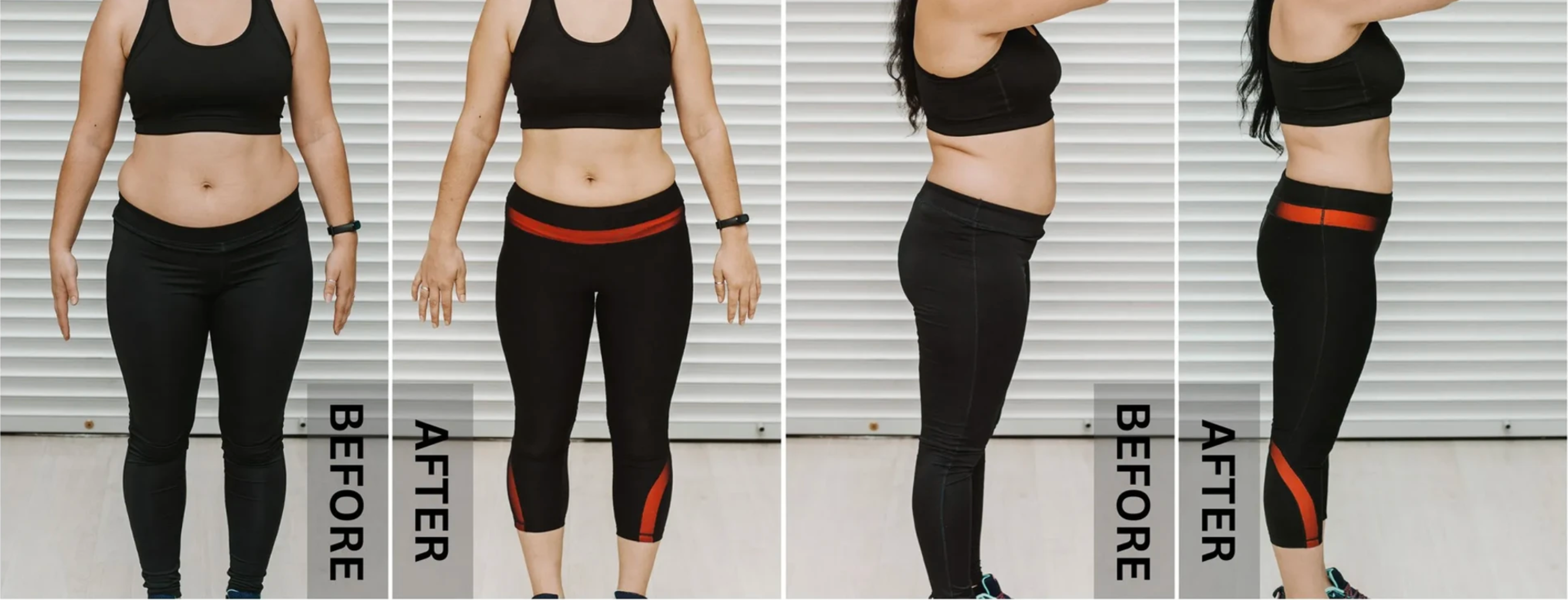 woman show her result by using red light therapy belt for 3 months