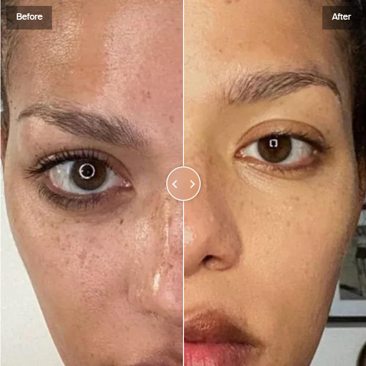 Led Light Mask Before and After Face: The Ultimate 2026 Transformation Guide