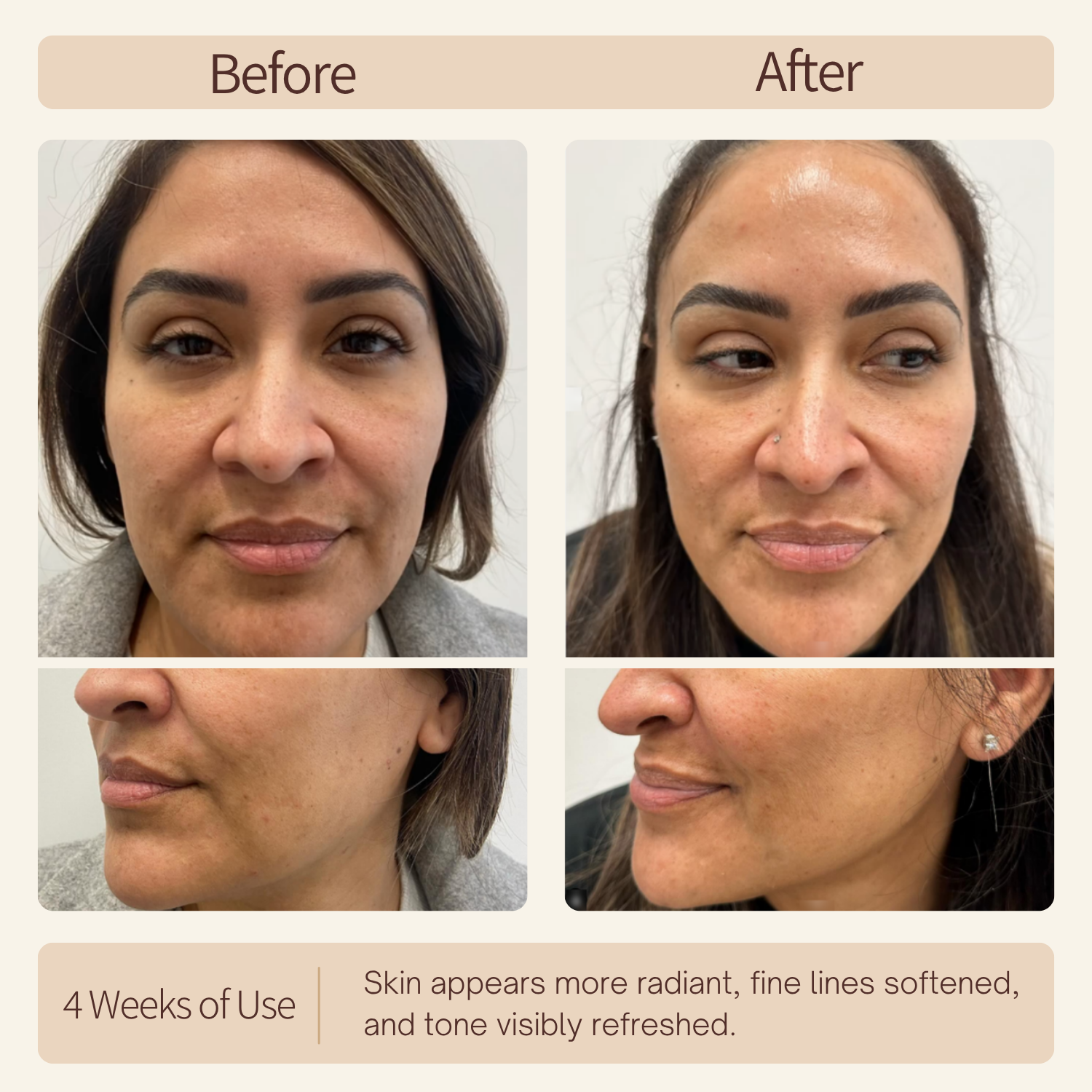 Before and after comparison of a woman's face with text indicating 4 weeks of use results.