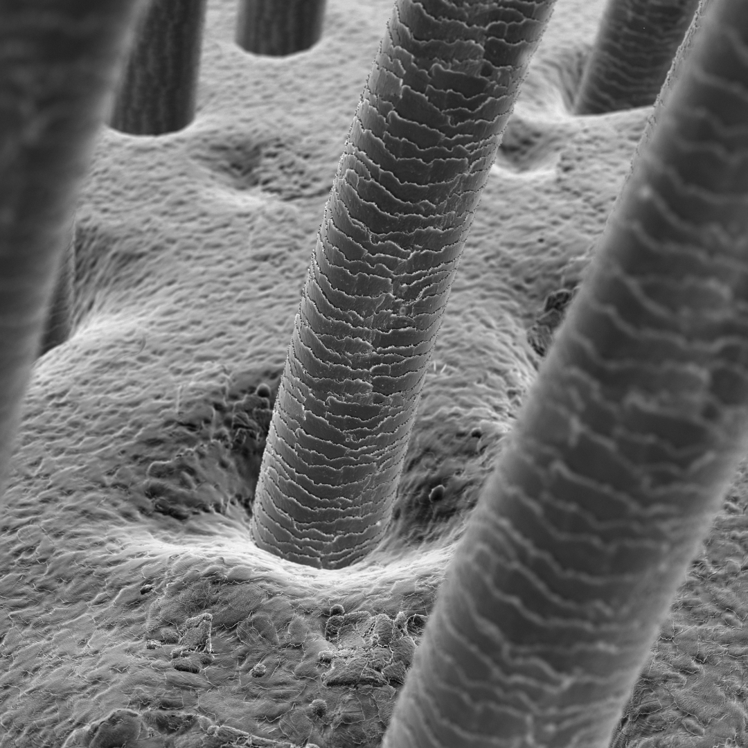 A detailed close-up of hair follicles under a microscope, showing healthy hair growth stimulated by scalp therapy.