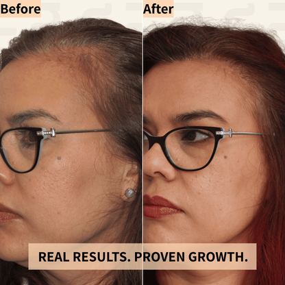 Nicebeam 3-in-1 Scalp Massager with Red Light Therapy for Hair Growth & Scalp Health