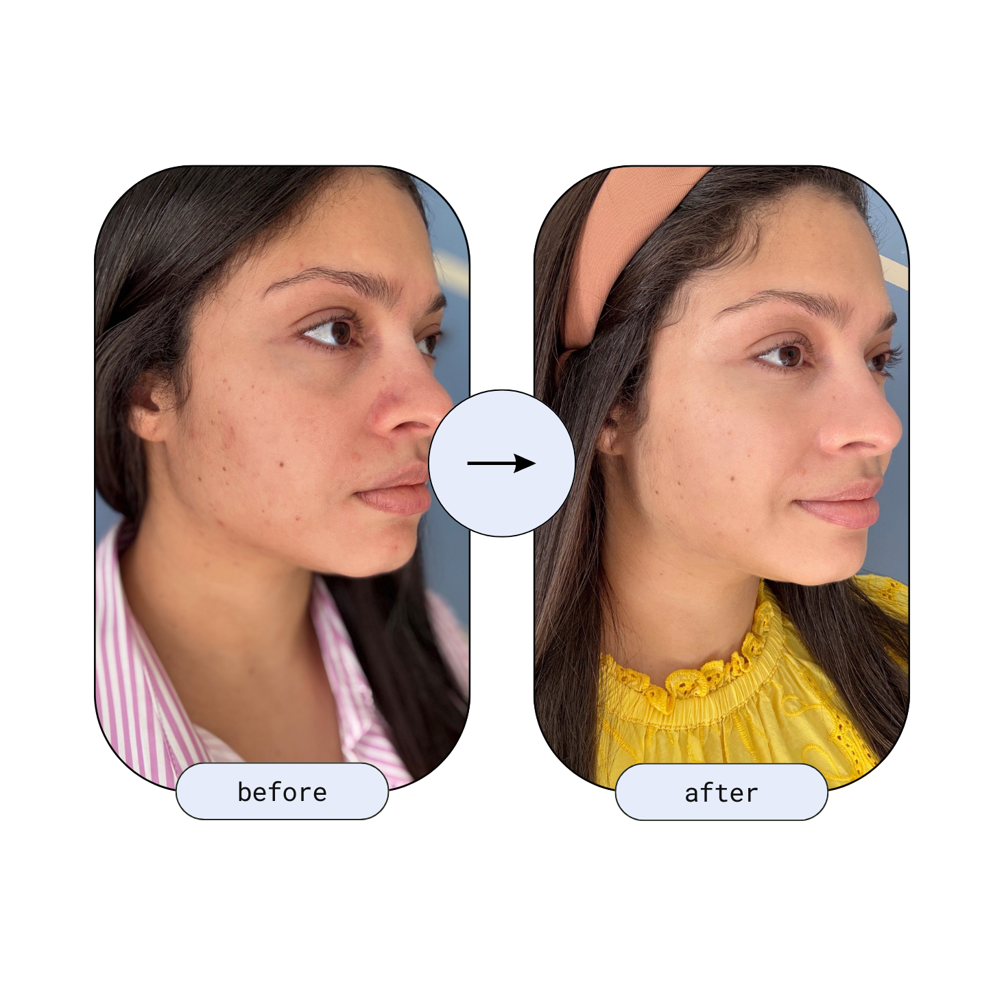 1. Effects on Skin