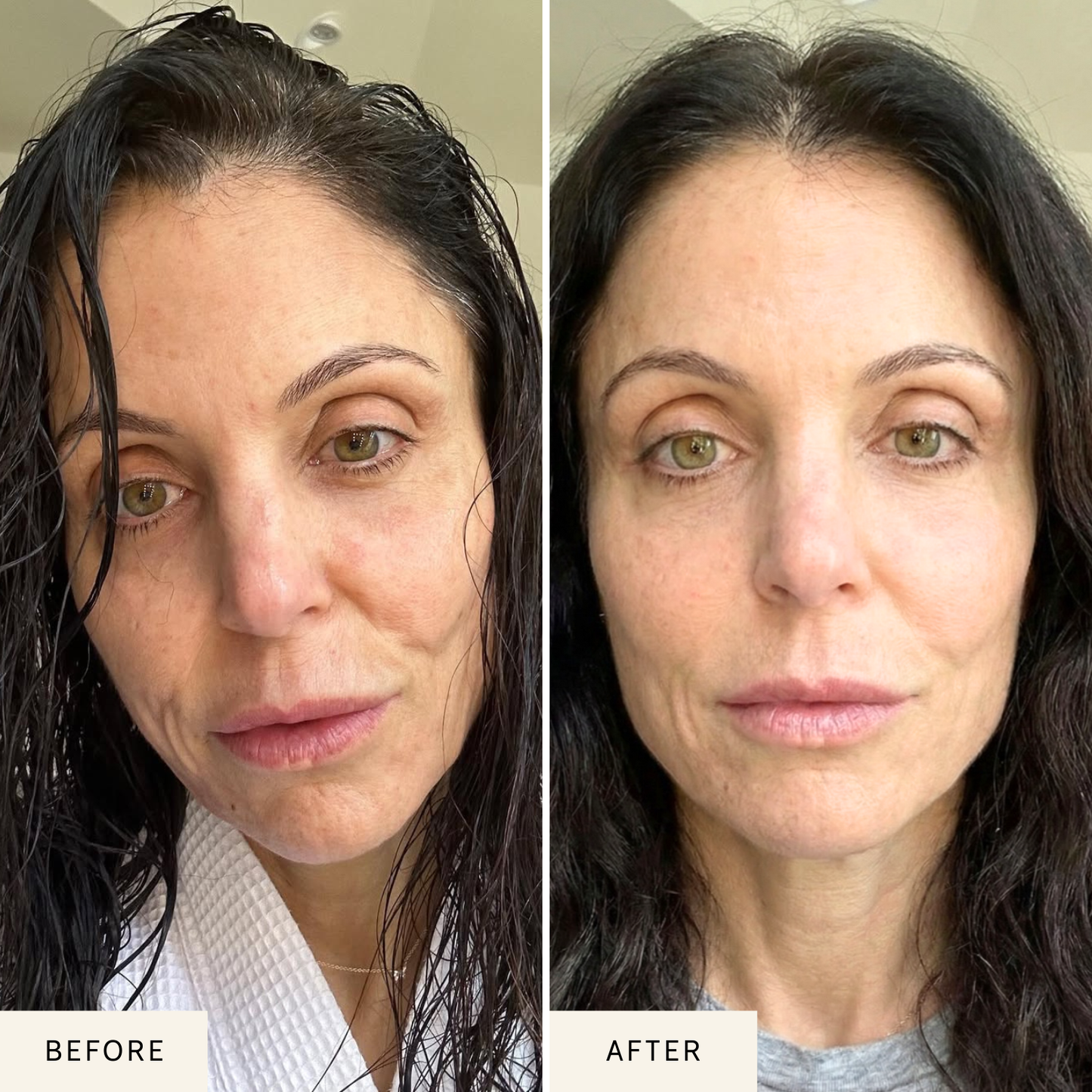 Nicebeam LED Red Light Therapy Face Mask