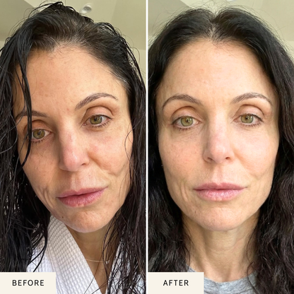 Nicebeam LED Red Light Therapy Face Mask