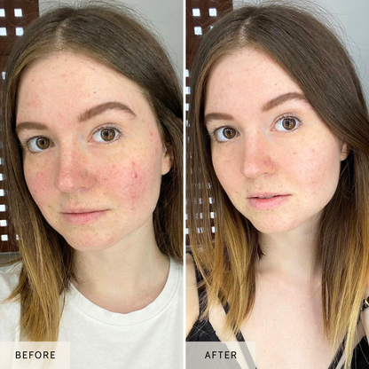 Nicebeam LED Red Light Therapy Face Mask