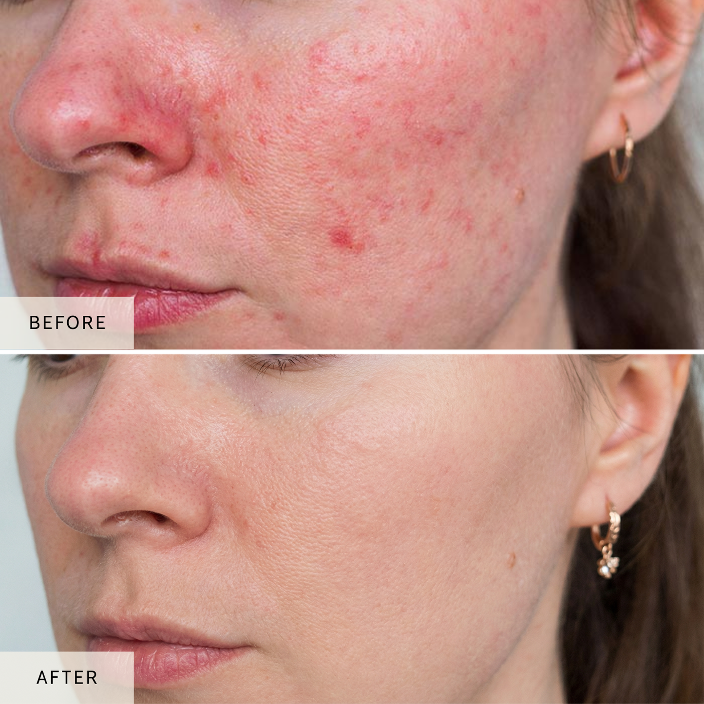 Nicebeam LED Red Light Therapy Face Mask