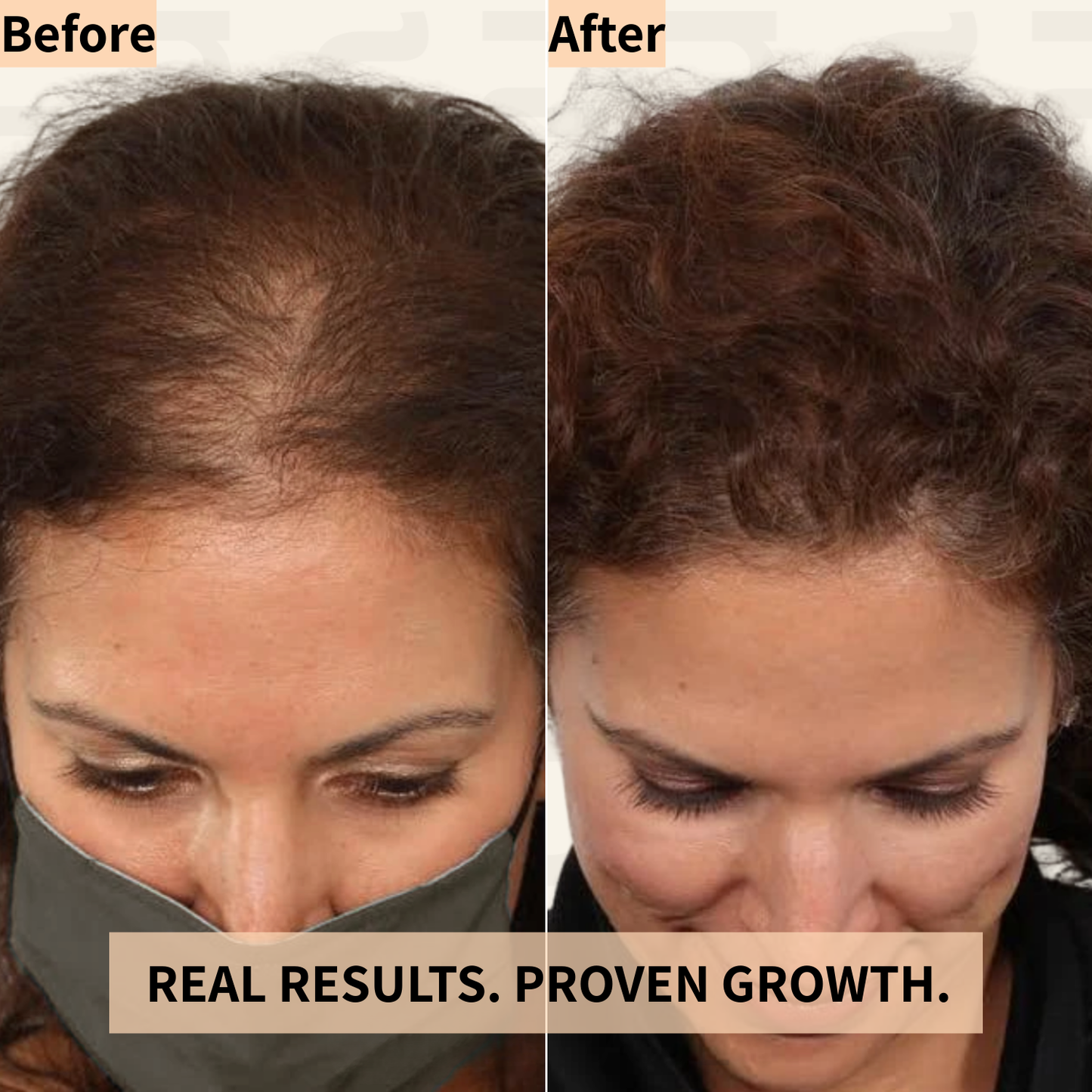 Nicebeam Red Light Therapy Hat