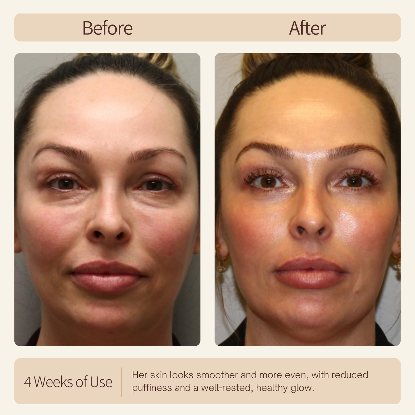 Nicebeam Sleep Recovery Lamp