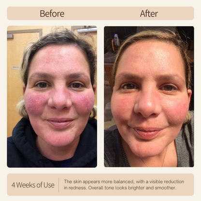 Nicebeam LED Light Therapy Time Machine for Face & Full Body