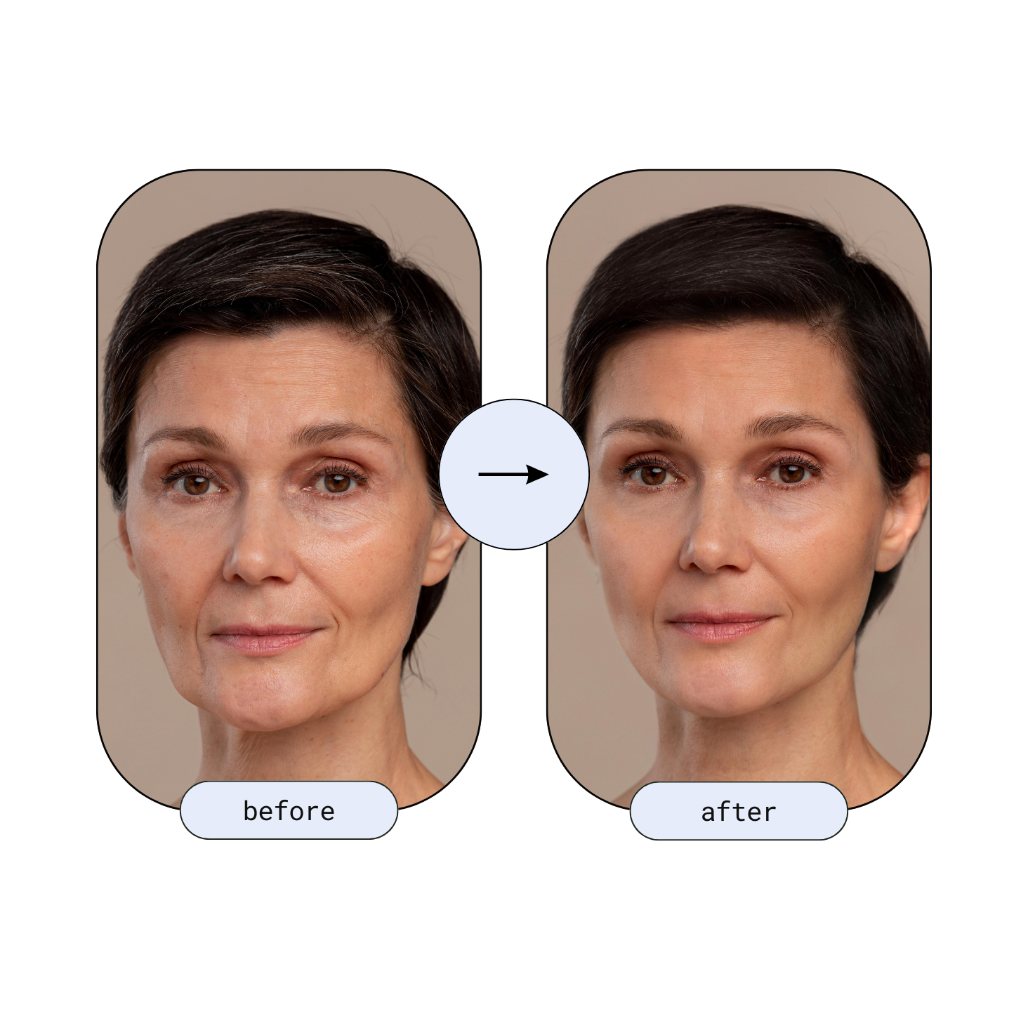 Before and after images showing noticeable face-lift effect and younger-looking skin after using the RLB Anti-Aging LED Mask.